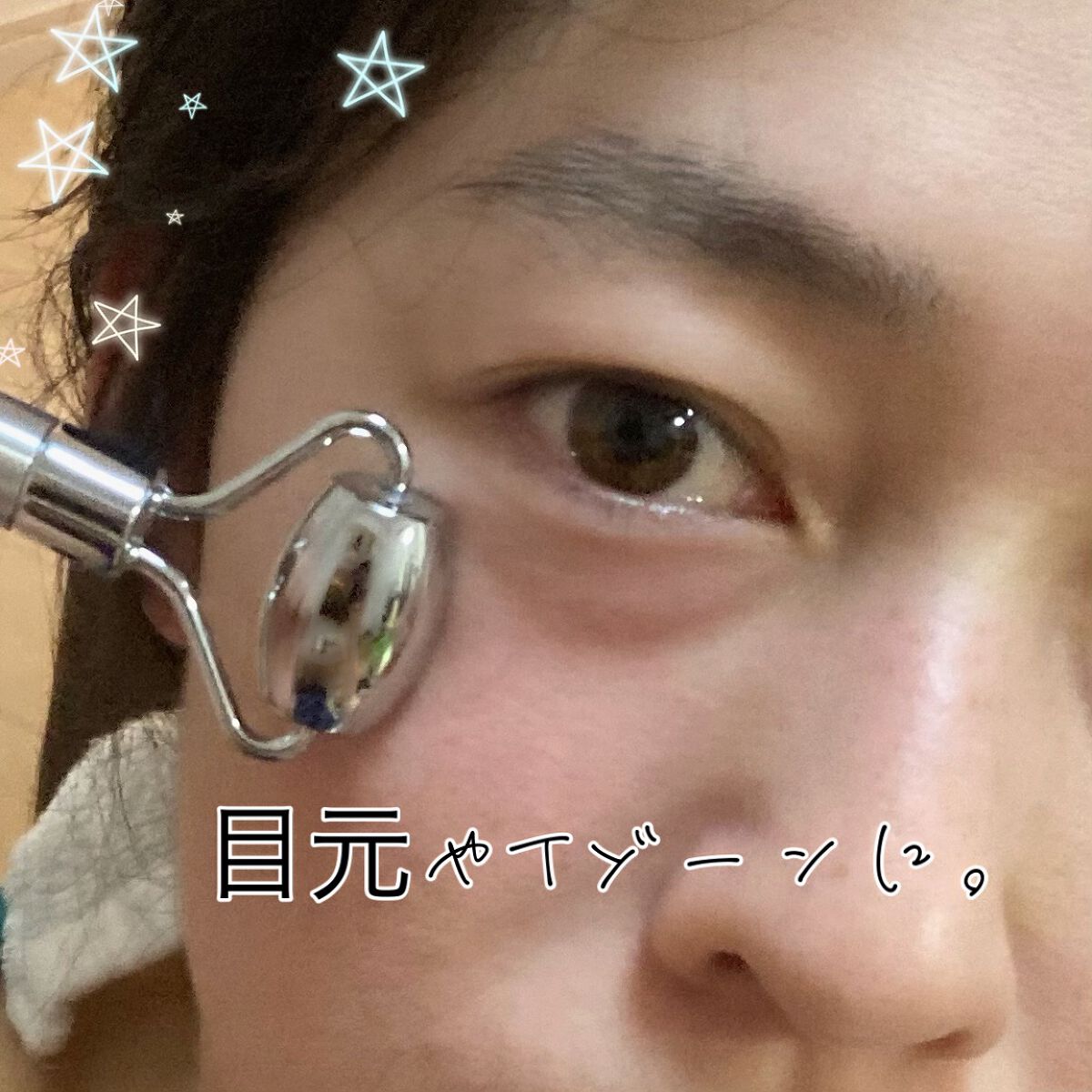 プロバイオダームリフティングフェイスローラー/BIOHEAL BOH/美顔器・マッサージを使ったクチコミ（3枚目）