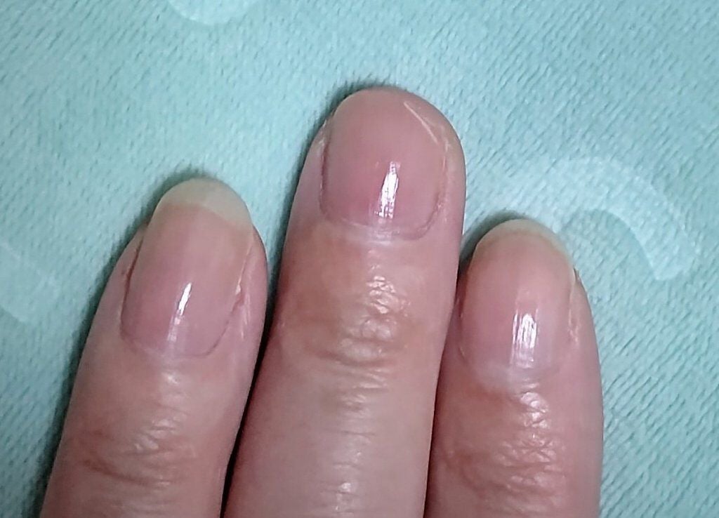 薬用ハンドクリーム/DHC/ハンドクリームを使ったクチコミ(1枚目)