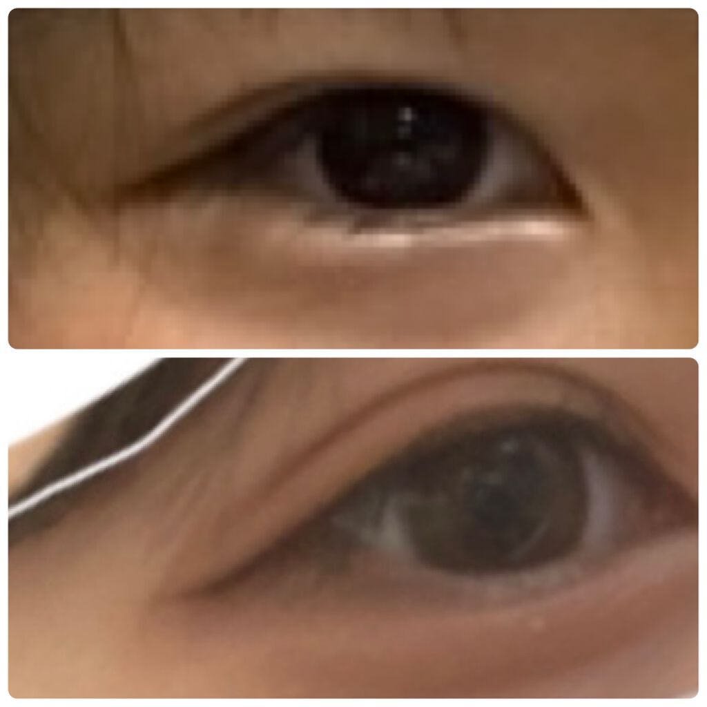 ayumi on LIPS 「私の目が垢抜けた方法~マッサージ・筋トレ編~目の下絶壁だねと母..」(2枚目)