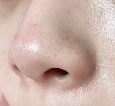 ホホバオイル 無印良品の使い方を徹底解説 鼻の黒ずみ 毛穴 ニキビに悩んでる方必見 By Yuun 普通肌 代前半 Lips