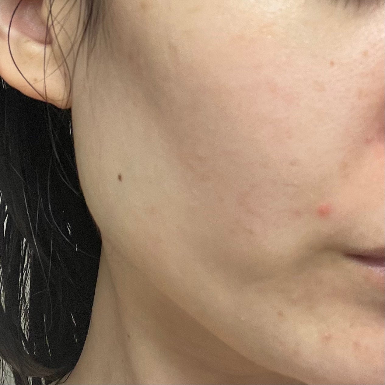 シカリニック PSL クリーム/CICALINIC/フェイスクリームを使ったクチコミ(4枚目)