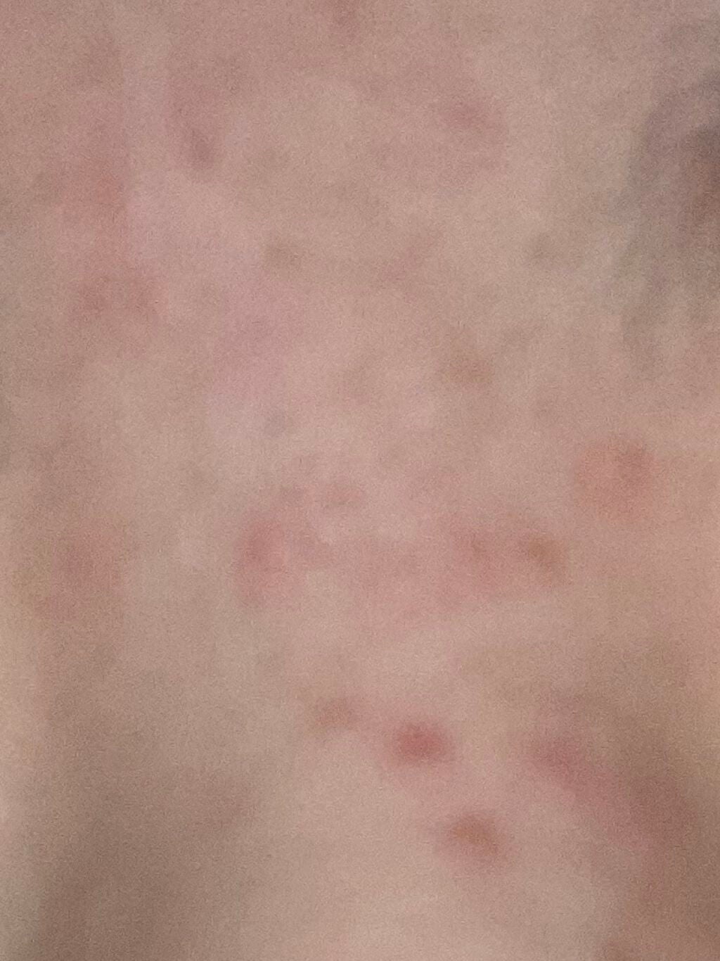 CICA カプセルマスク/VT/洗い流すパック・マスクを使ったクチコミ(7枚目)