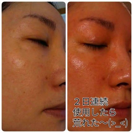 コラーゲンコアグローマスク/TIRTIR(ティルティル)/その他スキンケアを使ったクチコミ(6枚目)