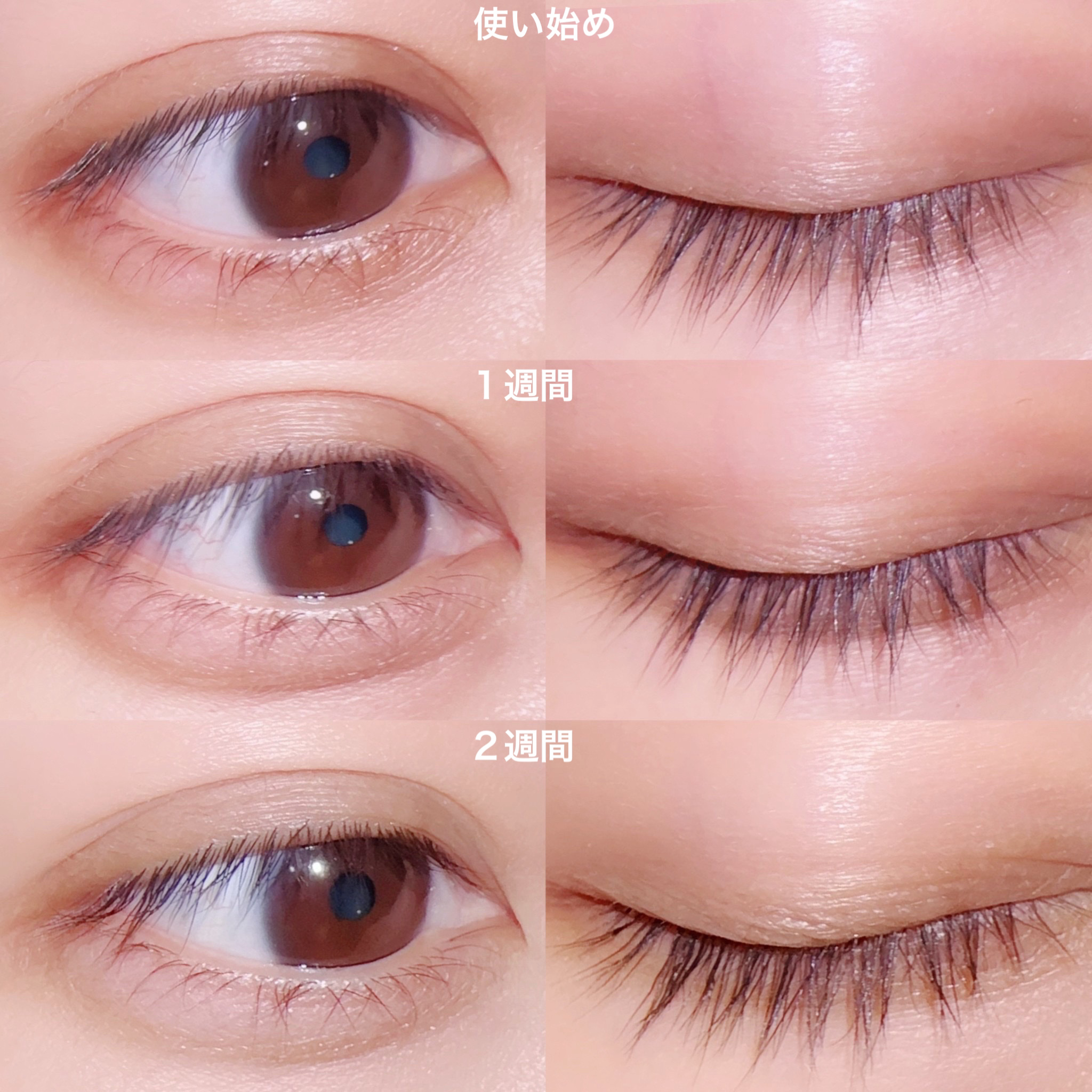 ロート製薬 ラッシュリッチ 2本セット まつ毛美容液 Amazon | 【公式】ロート製薬 ラッシュリッチ まつ毛美容液