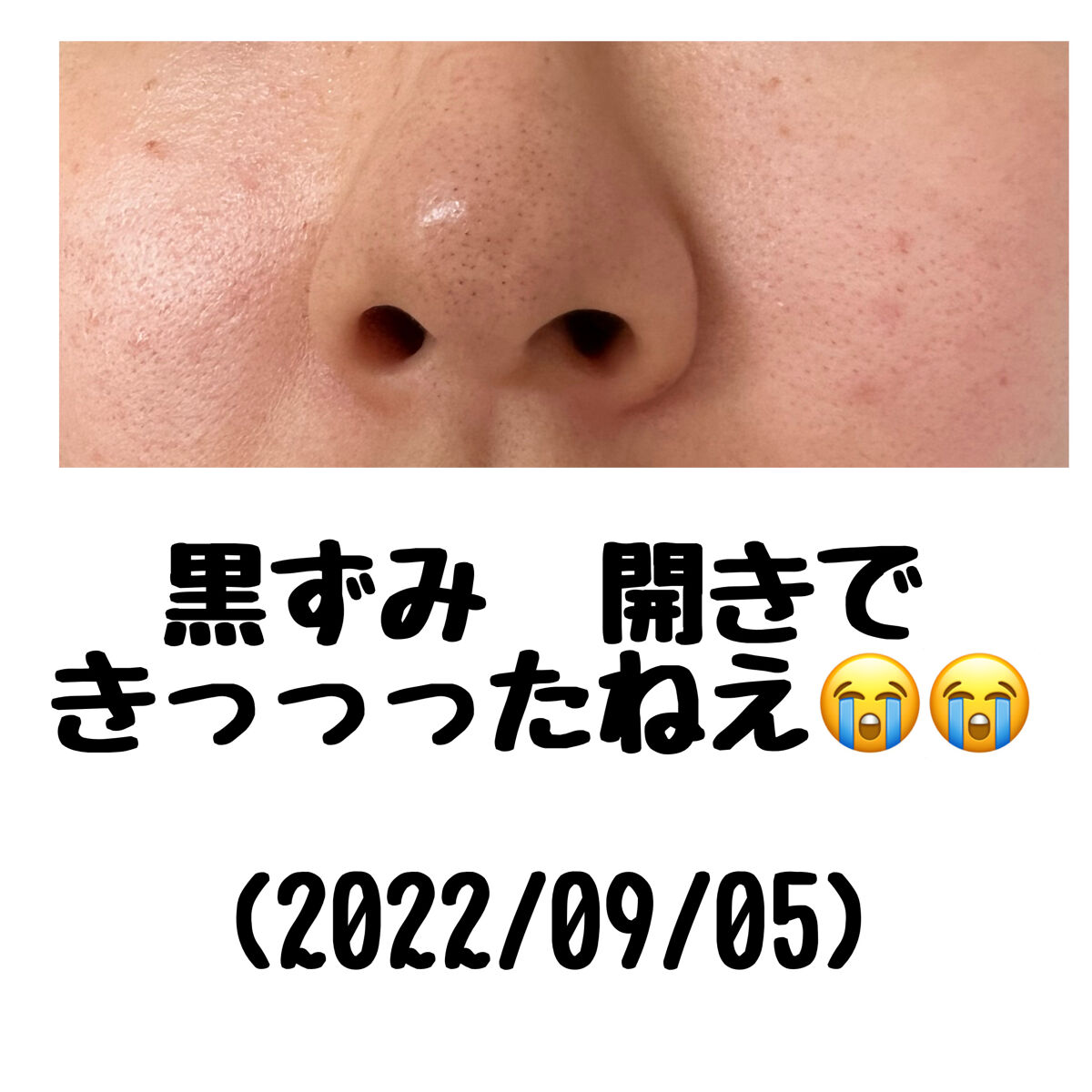 白潤プレミアム薬用浸透美白化粧水/肌ラボ/化粧水を使ったクチコミ（2枚目）