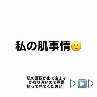 せなです✊🏻🌟
お久しぶりの投稿となります！
今回は私の肌事情についてお話したいと思います！

私は犬アレルギー持ちなのですが、犬を飼い始めて
スキンケアの仕方も丸々変わってしまいました😭
アレルギーで