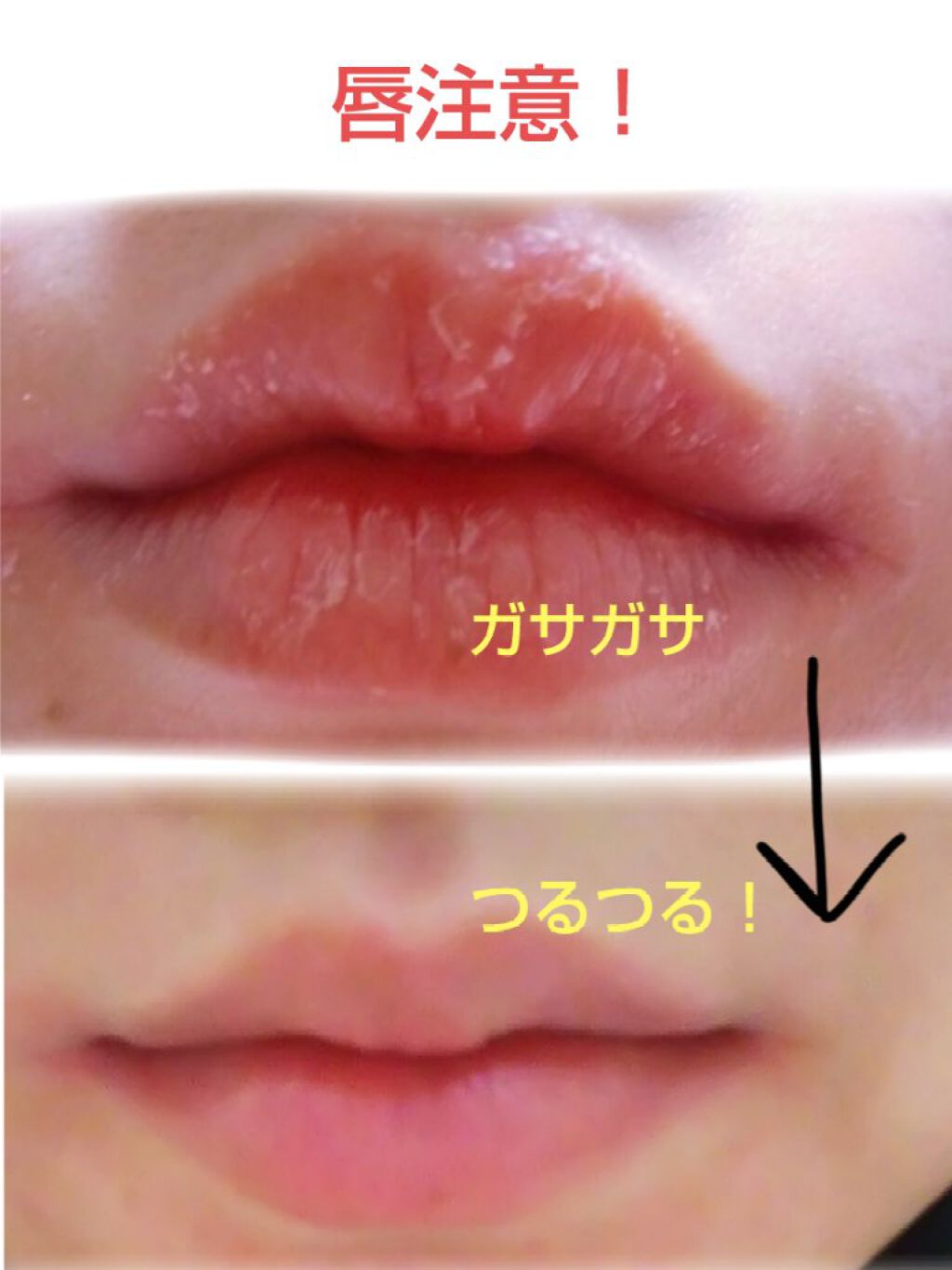 薬用メディカルリップスティックMn/メンターム/リップクリームを使ったクチコミ（2枚目）