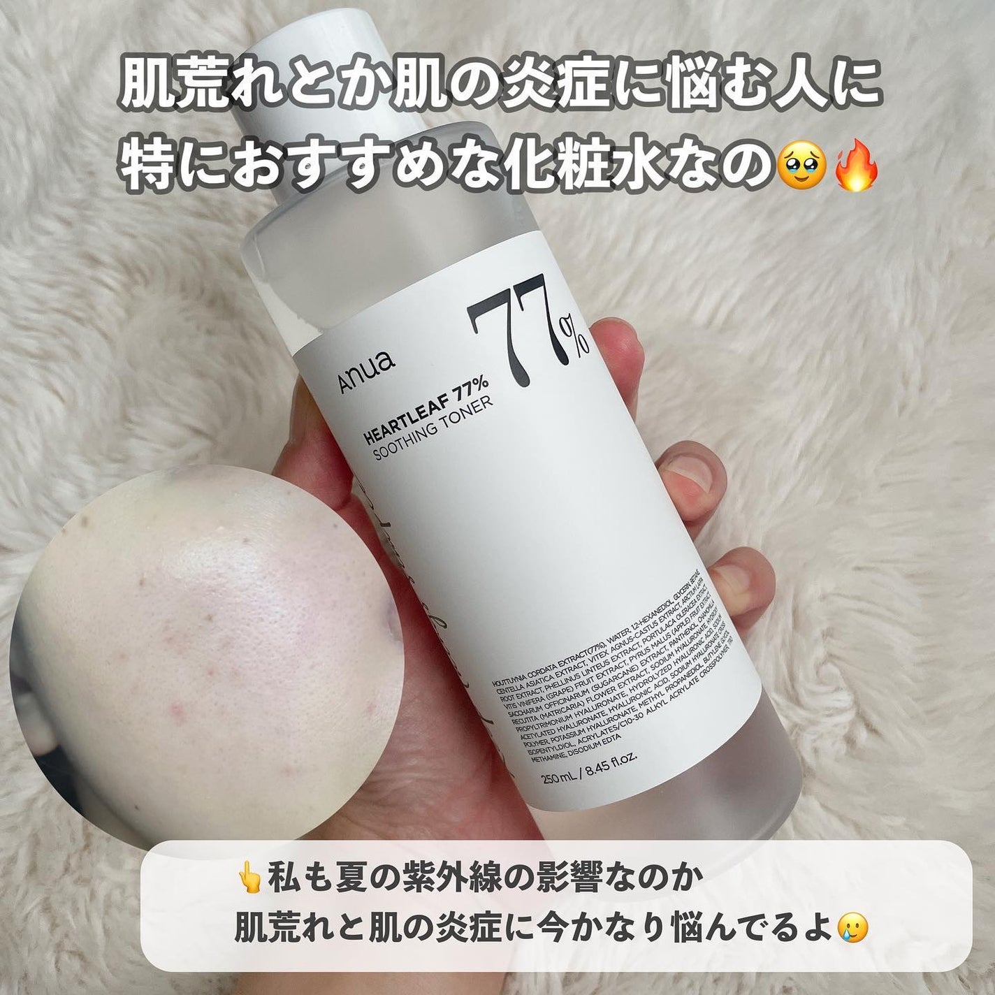 ドクダミ 77 スージングトナー/Anua/化粧水を使ったクチコミ(4枚目)