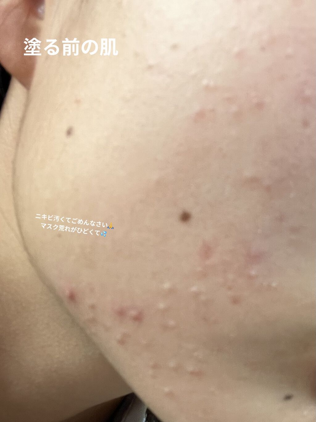 ネオクッション グロウ/LANEIGE/クッションファンデーションを使ったクチコミ（2枚目）