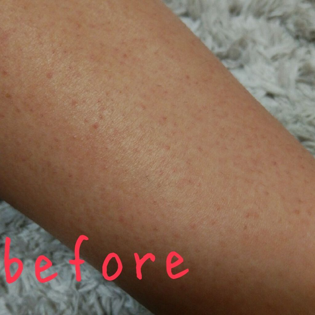 ハトムギ化粧水(ナチュリエ スキンコンディショナー R )/ナチュリエ/化粧水を使ったクチコミ（2枚目）