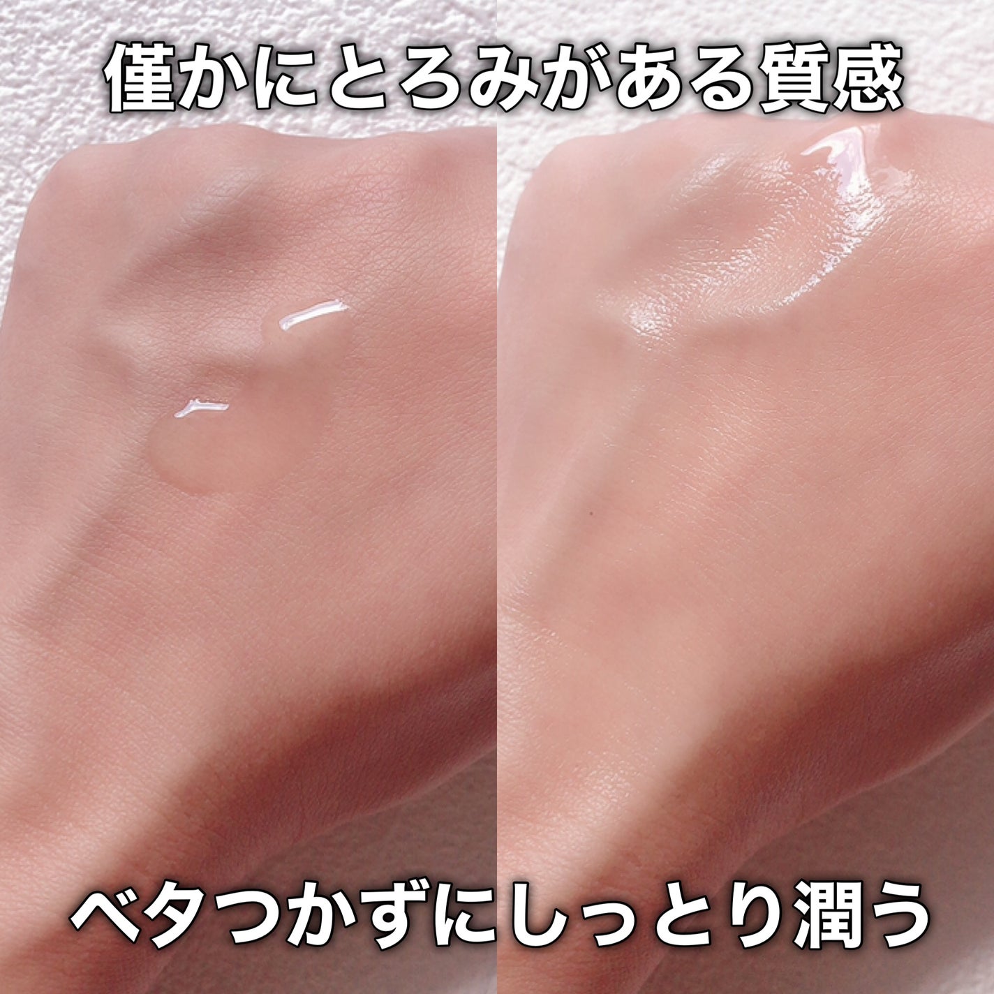 ノスカナイン トラブル セラム/FATION/美容液を使ったクチコミ(5枚目)