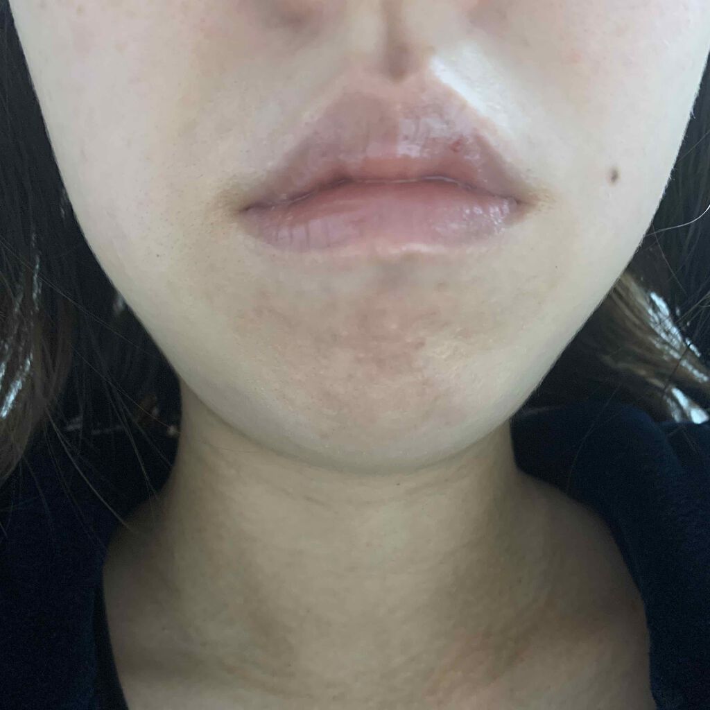 DHC 薬用リップクリーム/DHC/リップクリームを使ったクチコミ(2枚目)