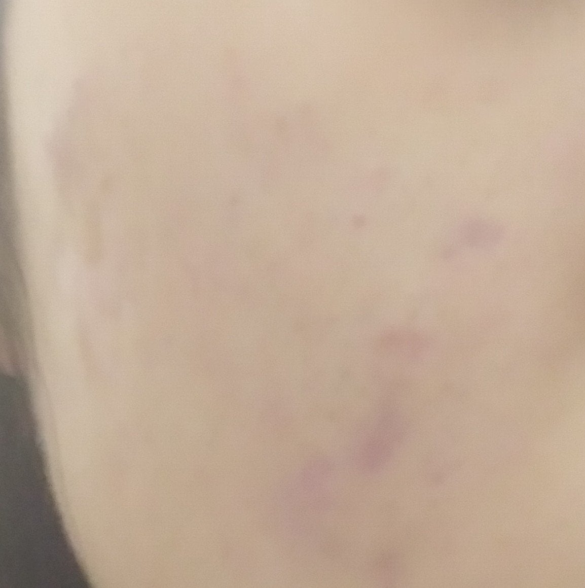 あみ on LIPS 「今日はいつものスキンケアにプラスしてパックもしてみました!ci..」(1枚目)