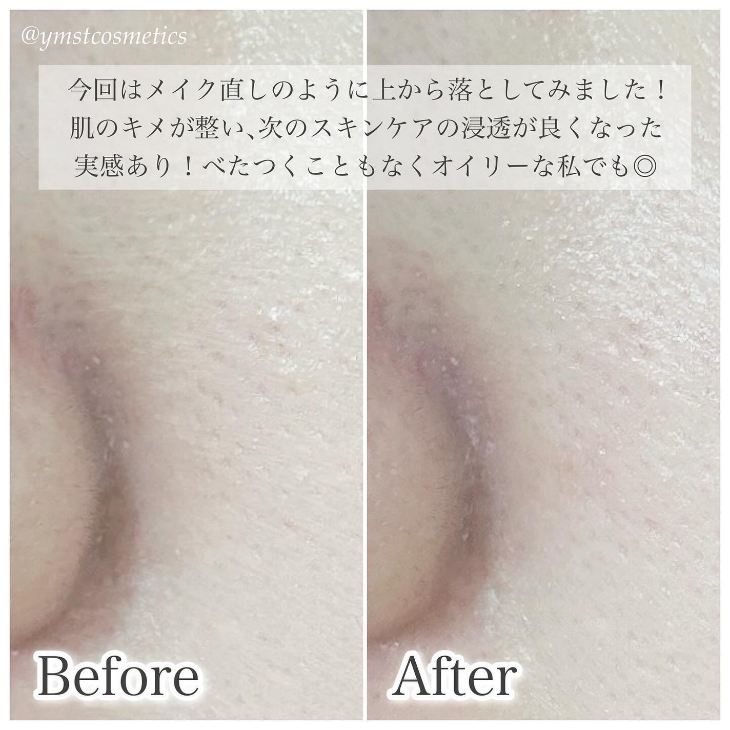 サニーサワー ミルク/IGNIS/乳液を使ったクチコミ(6枚目)