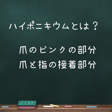 [ハイポニキウムをぐんぐん伸ばすネイルオイル♡]

こんにちはゆきたんです😊

以前サロンで自爪育成したことについて投稿しましたが、サロンにいかなくてもハイポニキウムがぐんぐん伸びるオイルを見つけました🤩

サロンでクリアジェルを塗らなくなってから、あまりハイポニキウムが伸びなくなっていました…

が！
このオイルに出会って、再びぐんぐん伸び始めたんです！！

カントリー&ストリーム　ハニーネイルトリートメントオイル ¥1100

香りは本物のはちみつのよう(まるでプーさんのハニーハントに乗っている気分でした♡)

※やり方は画像参照


実は塗るタイミングもとても重要‼️
今の時期はとても乾燥するので、手洗いするたびに塗る事！
ですが、マニキュアタイプのネイルオイルよりずっとこってりしているので、ちゃんとつけた後は数時間後もしっとり♡

ショートネイルの方、私みたいに爪にコンプレックスがある方におすすめです！

#自爪育成 #ハイポニキウム  #本音レポ  #ネイルトリートメント #ネイルオイル おの画像 その1