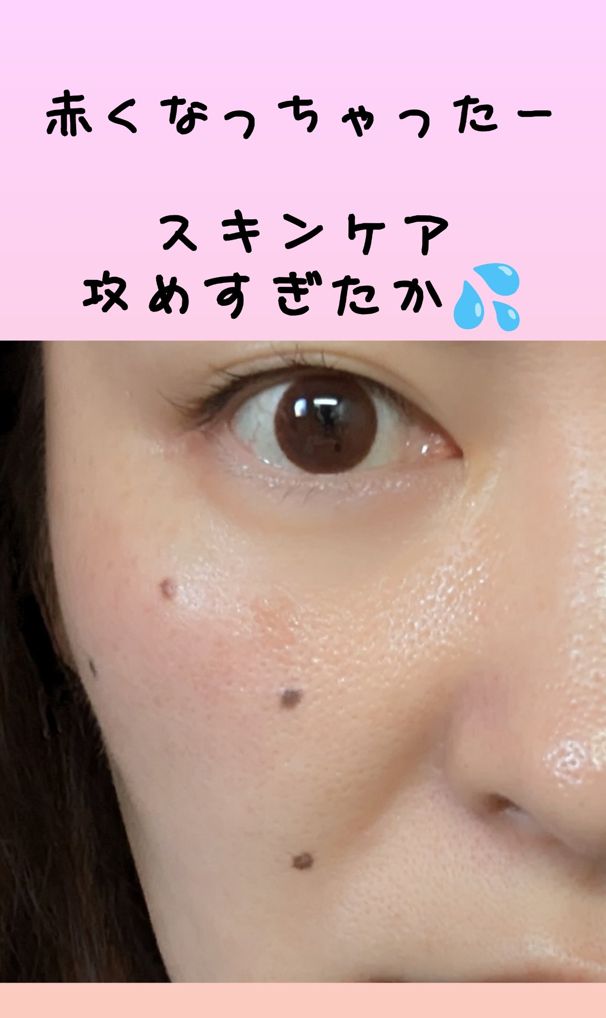 ハイドロクリームPHQ-8/KISO/美容液を使ったクチコミ（1枚目）