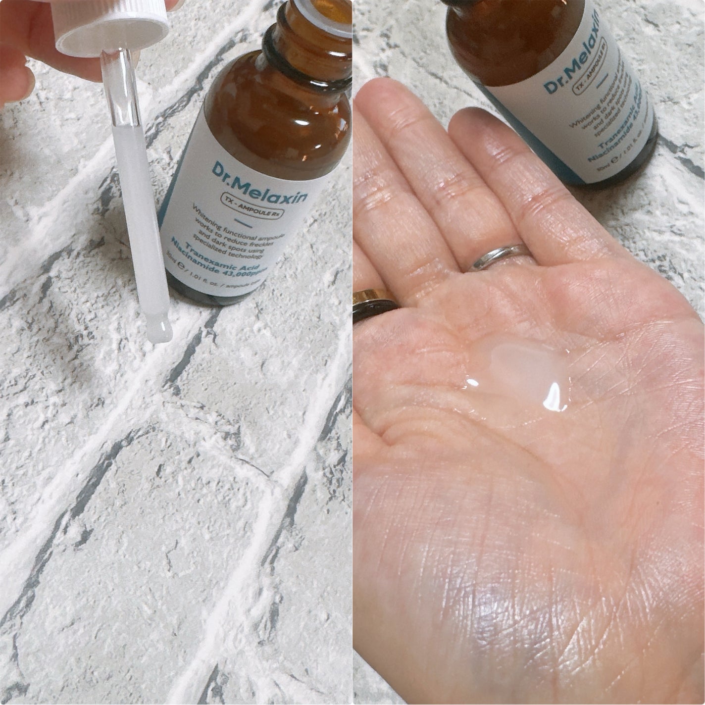 TX-Cream/Dr.Melaxin/フェイスクリームを使ったクチコミ(5枚目)