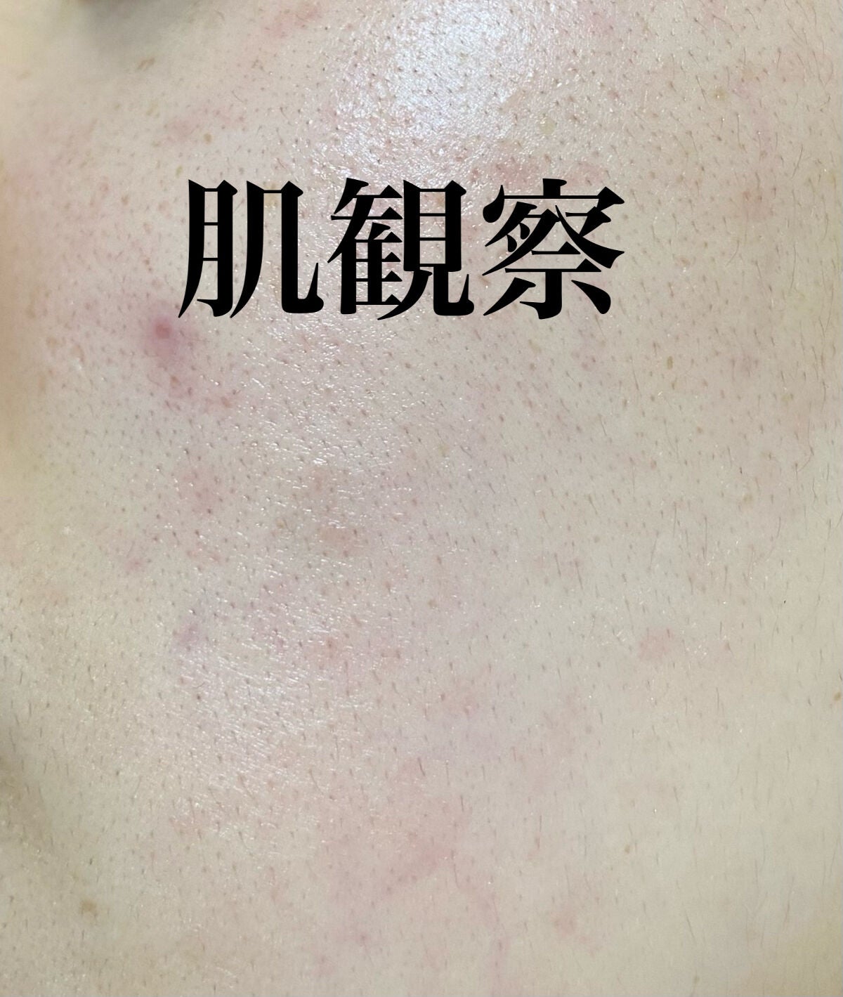 Rエッセンス/unlabel/美容液を使ったクチコミ(1枚目)