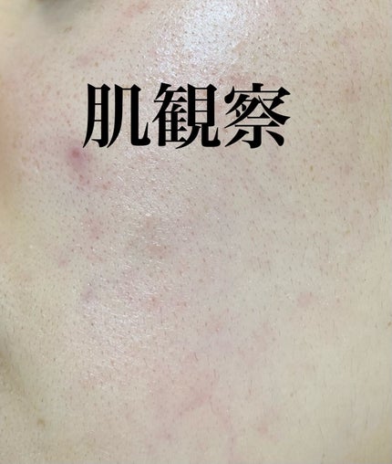 Rエッセンス/unlabel/美容液を使ったクチコミ(1枚目)