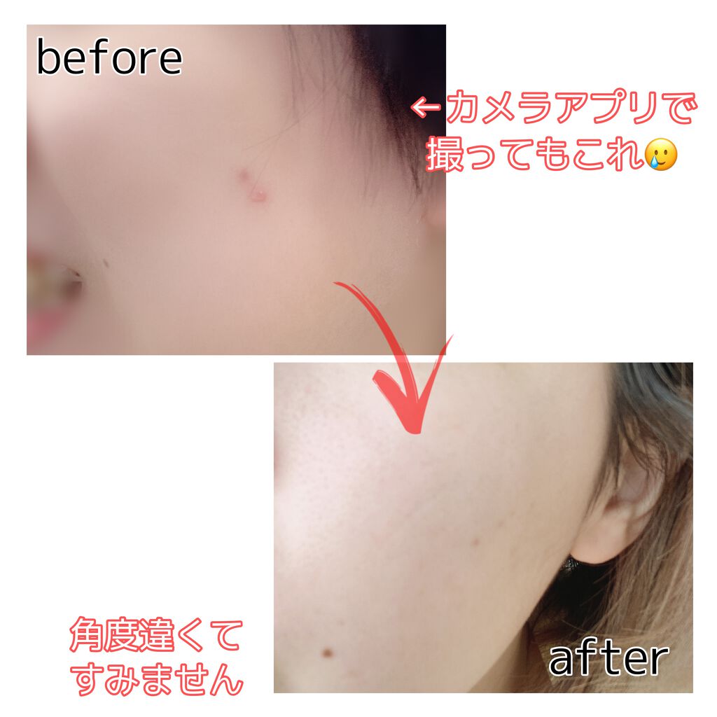 エイジインテンストリートメント スペシャルセット/FROM NATURE/スキンケアキットを使ったクチコミ（2枚目）