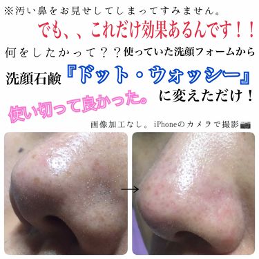 ドット ウォッシー洗顔石鹸 ペリカン石鹸の効果に関する口コミ 2枚目 汚い肌載せてます シミだらけで By いまもん Lips ドット ウォッシー洗顔石鹸 ペリカン石鹸の効果に関する口コミ 2枚目 汚い肌載せてます シミだらけで By いまもん Lips
