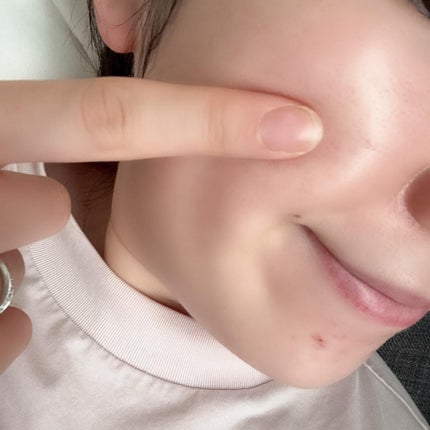 バクチオールAアンプル/23years old/美容液を使ったクチコミ(5枚目)