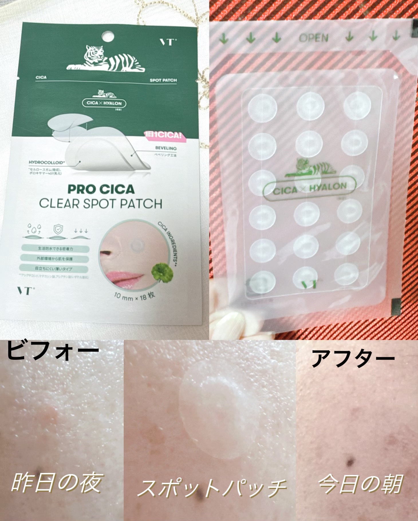 プロCICA クリアスポットパッチ/VT/その他スキンケアを使ったクチコミ（2枚目）