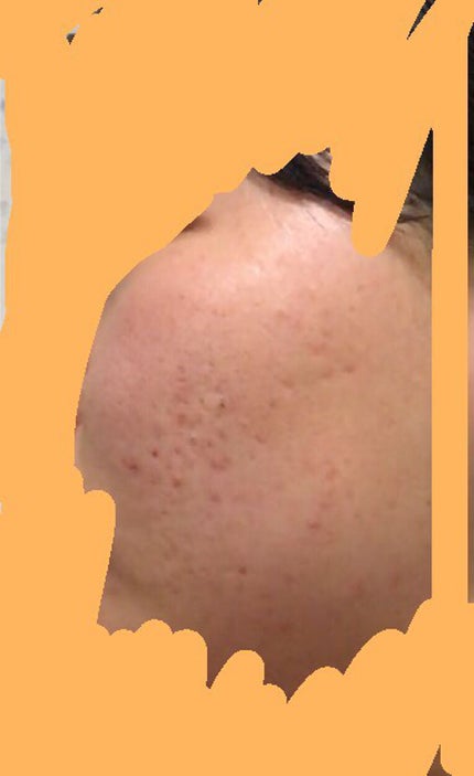 ハトムギ化粧水(ナチュリエ スキンコンディショナー R )/ナチュリエ/化粧水を使ったクチコミ(3枚目)