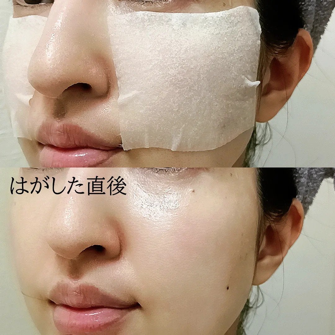 フィグブースティングエッセンス/I'm from/化粧水を使ったクチコミ(3枚目)