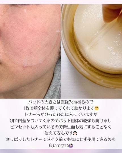 センテラ クイックカーミングパッド/SKIN1004/トナーパッドを使ったクチコミ(3枚目)