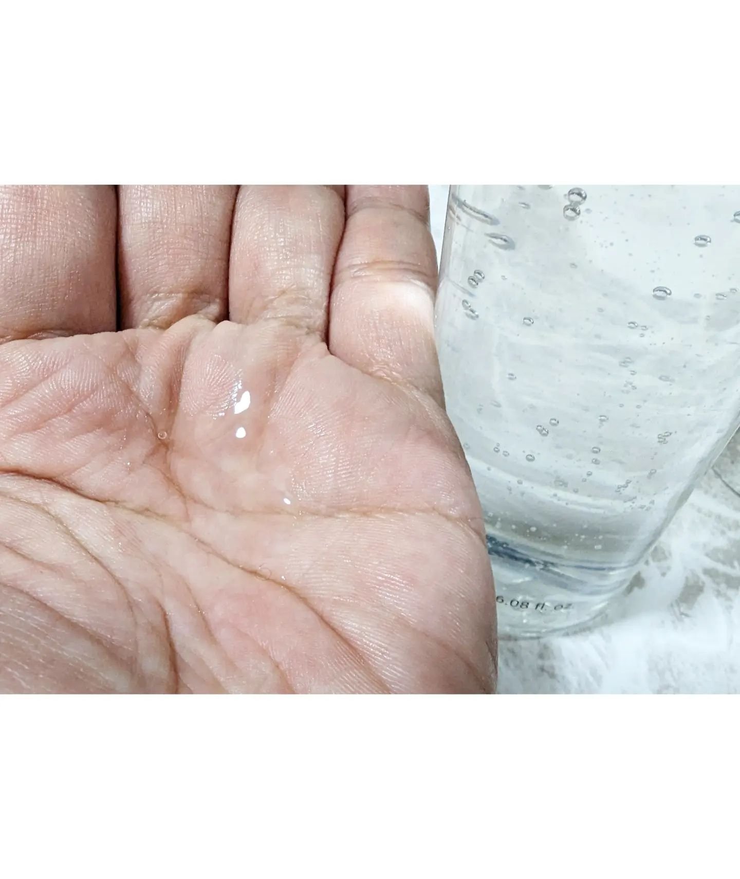 アクアヒアルロニックエッセンス/ロベクチン/化粧水を使ったクチコミ（2枚目）