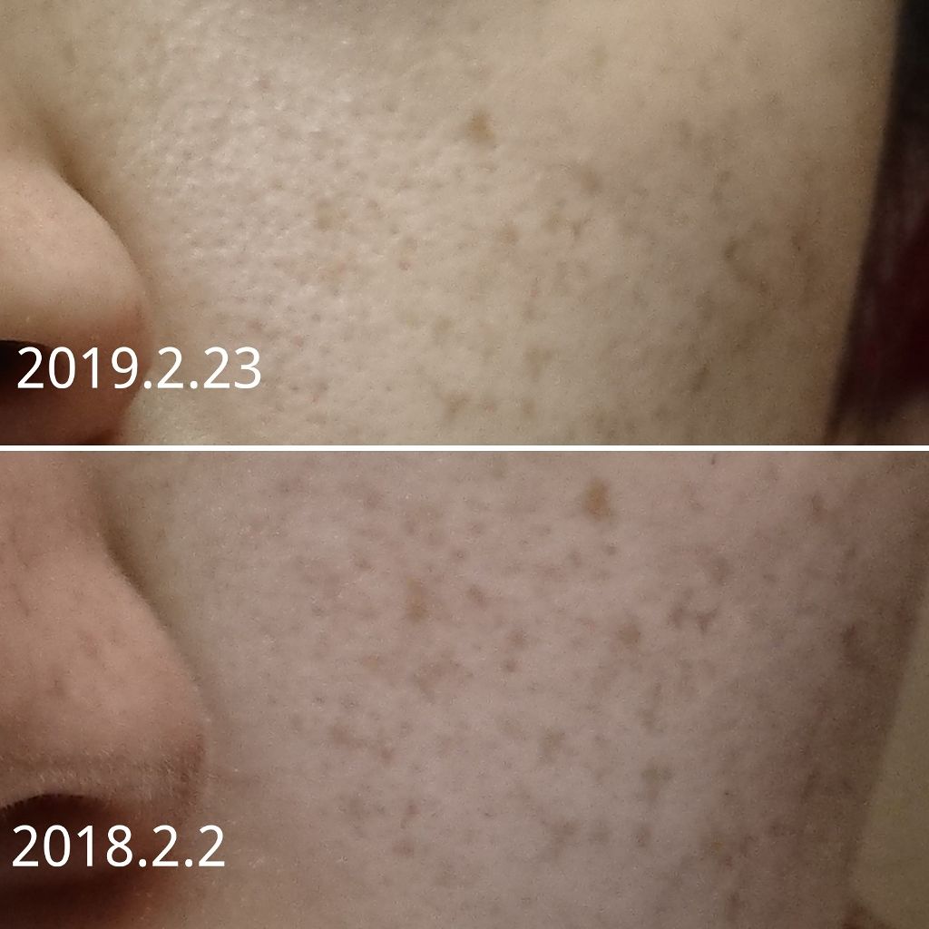 ブライトニングフォーミュラ/メコゾーム/フェイスクリームを使ったクチコミ(2枚目)