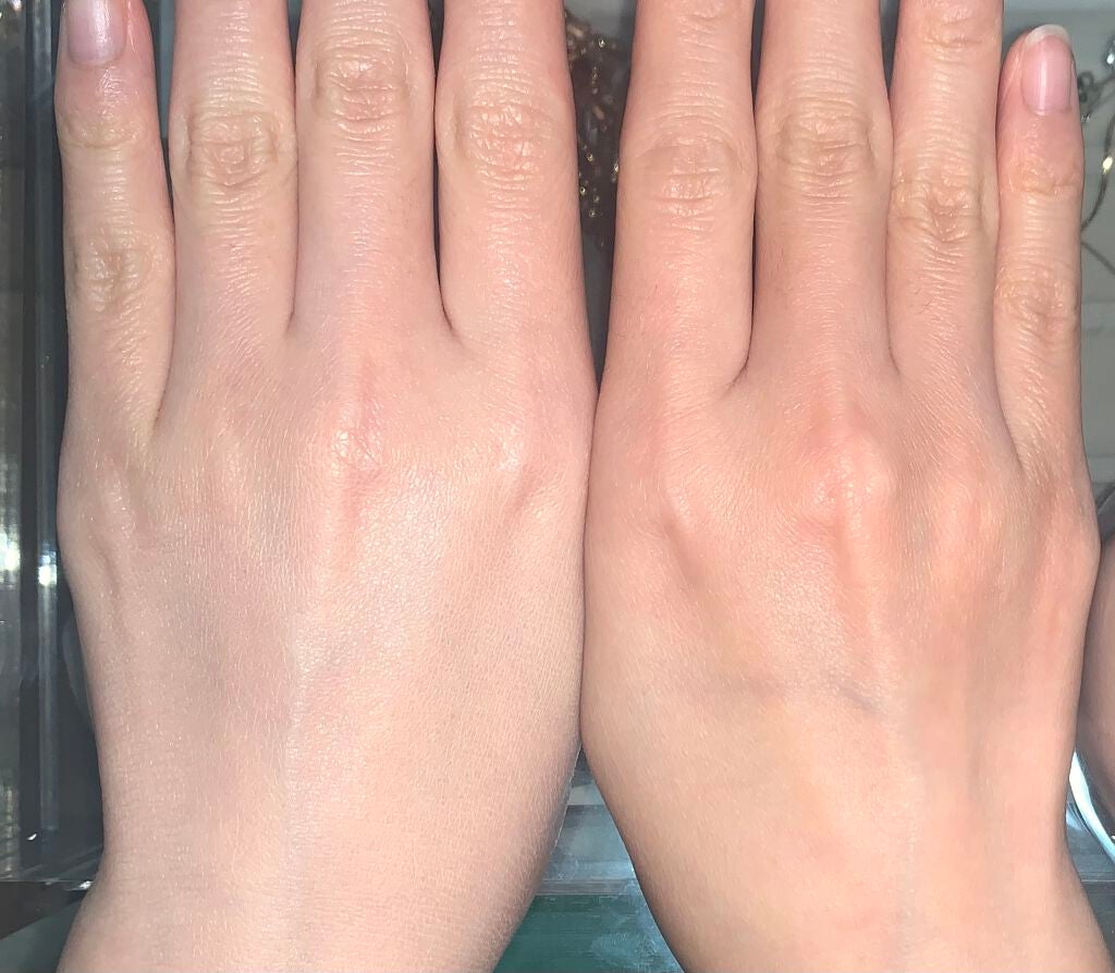 ドクタージャルト シカペア リカバー (第2世代)/Dr.Jart+/フェイスクリームを使ったクチコミ(3枚目)