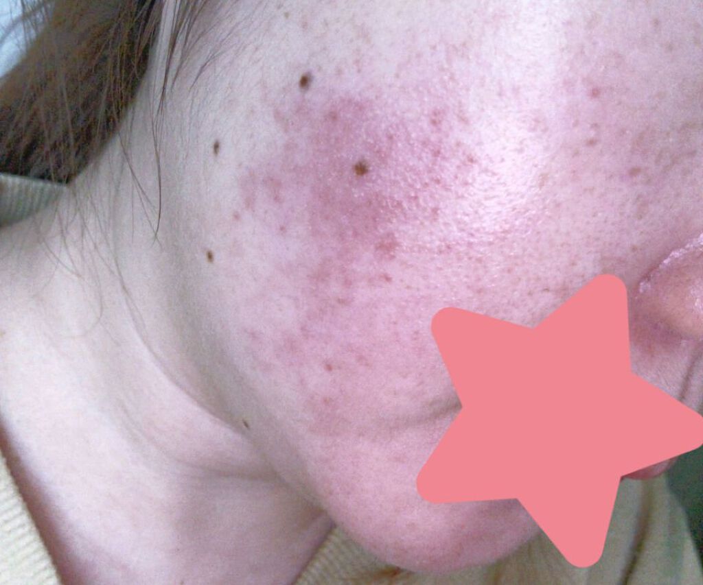 サンホワイトP-1/サンホワイト/ボディクリームを使ったクチコミ（2枚目）