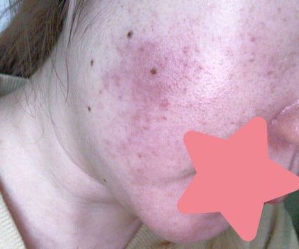 サンホワイトP-1/サンホワイト/ボディクリームを使ったクチコミ(2枚目)