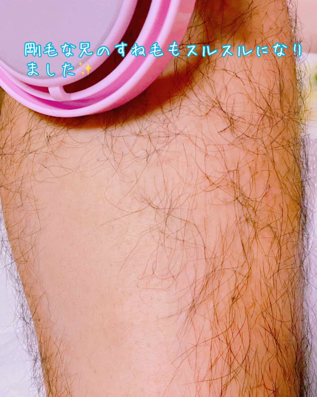 つるすべ除毛パッド/DAISO/ムダ毛ケアを使ったクチコミ（2枚目）