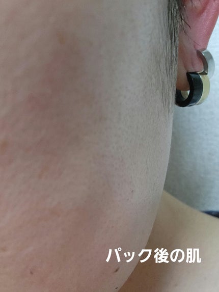 うるうるBOMBマスク/クリアターン/シートマスク・パックを使ったクチコミ(5枚目)