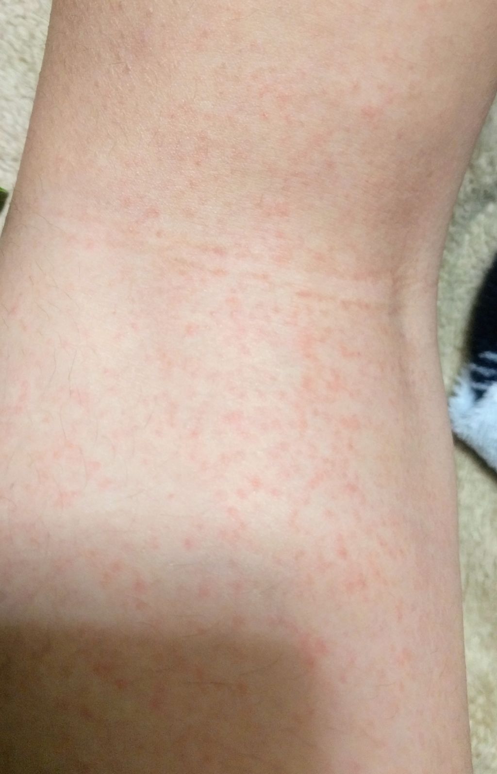 ジョンソン ベビーオイル 無香料/ジョンソンベビー/ボディオイルを使ったクチコミ(4枚目)