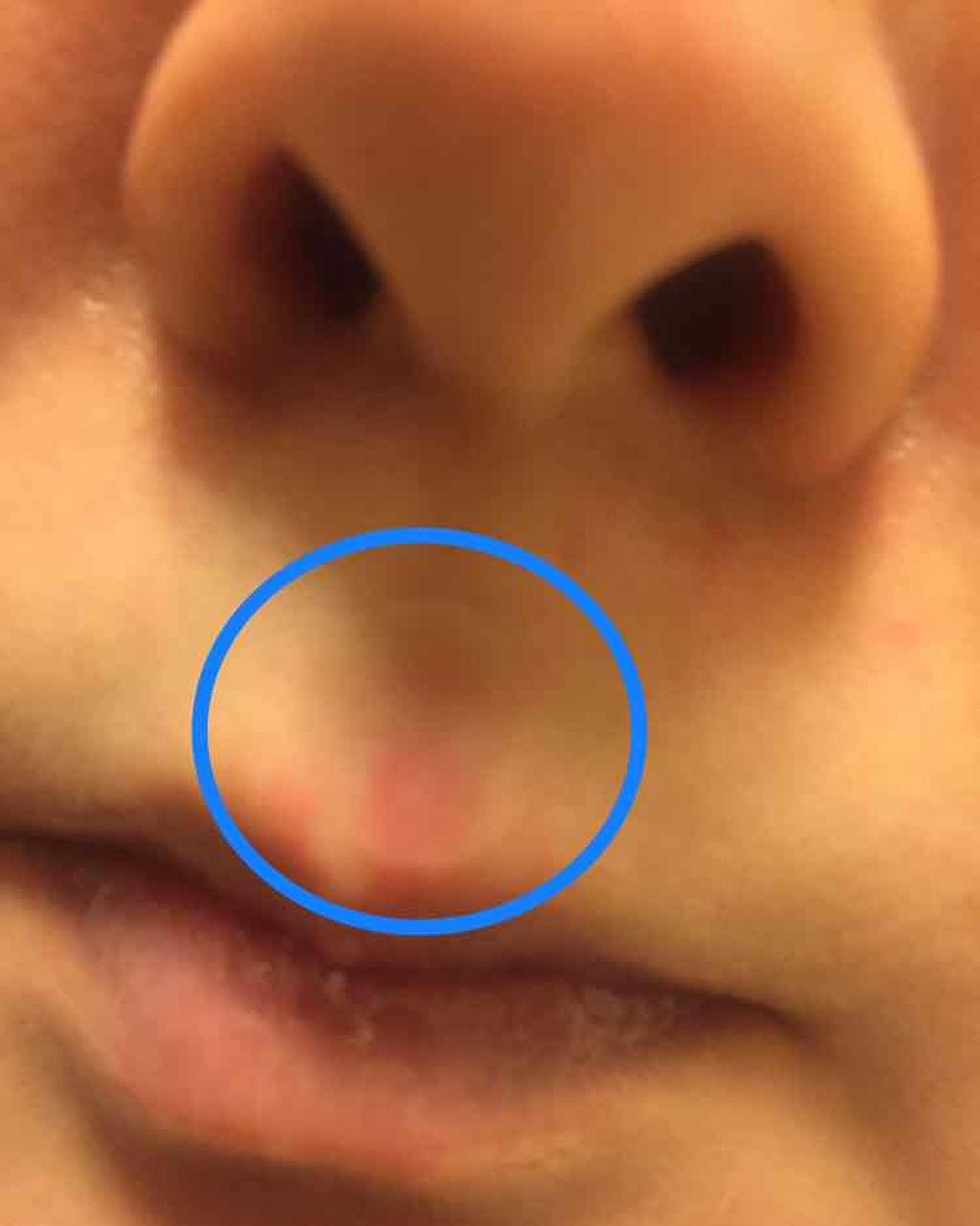 オリーブヤング ケアプラス/Olive Young/その他を使ったクチコミ（3枚目）