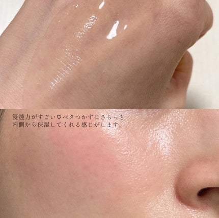 チェリーブロッサムブレミッシュ8GFセラム/Bring Back/化粧水を使ったクチコミ(7枚目)