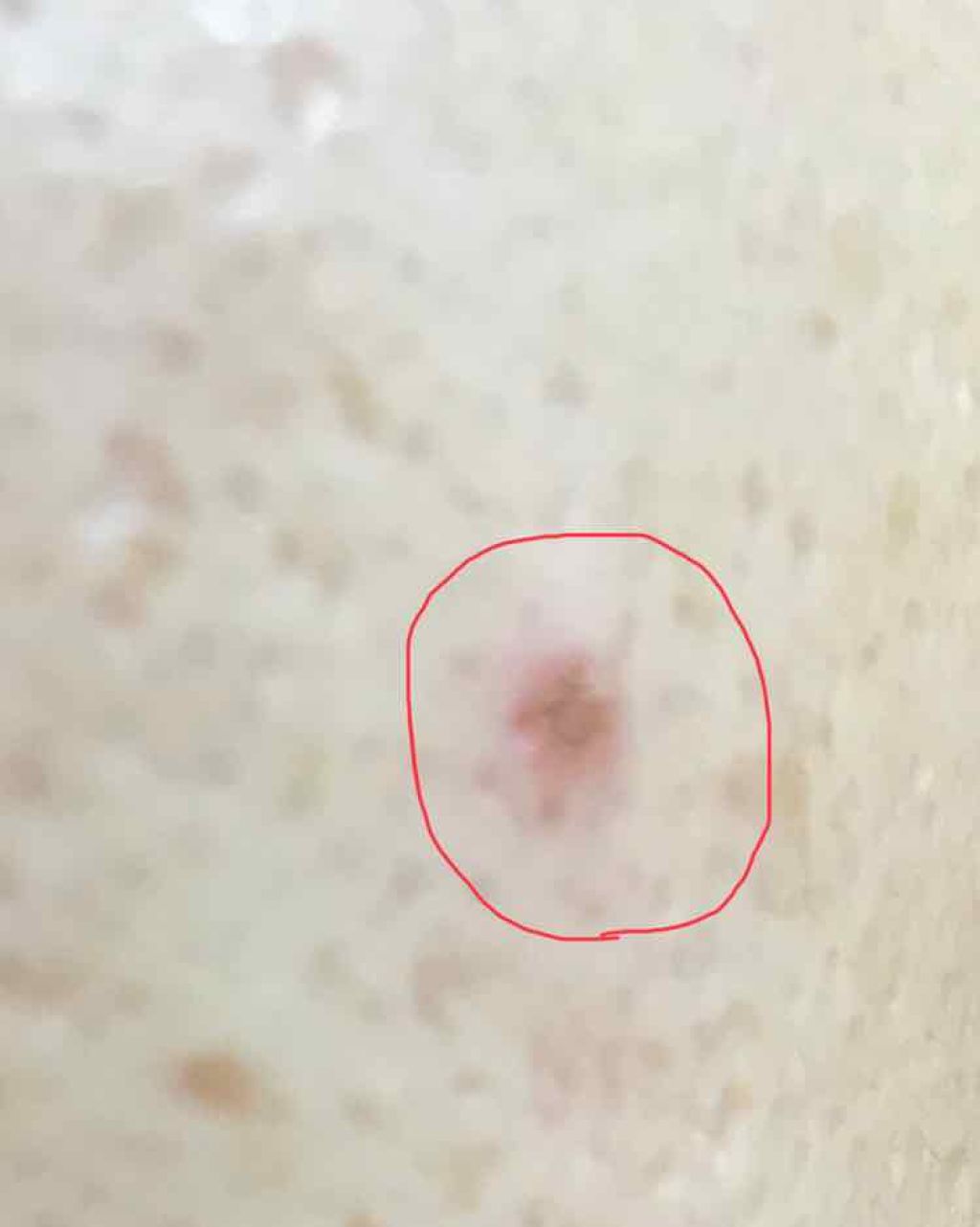 カバーパーフェクション チップコンシーラー/the SAEM/リキッドコンシーラーを使ったクチコミ（2枚目）