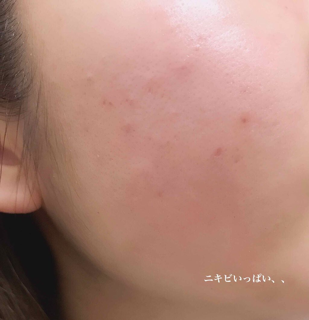 明色美顔水 薬用化粧水/美顔/化粧水を使ったクチコミ(2枚目)