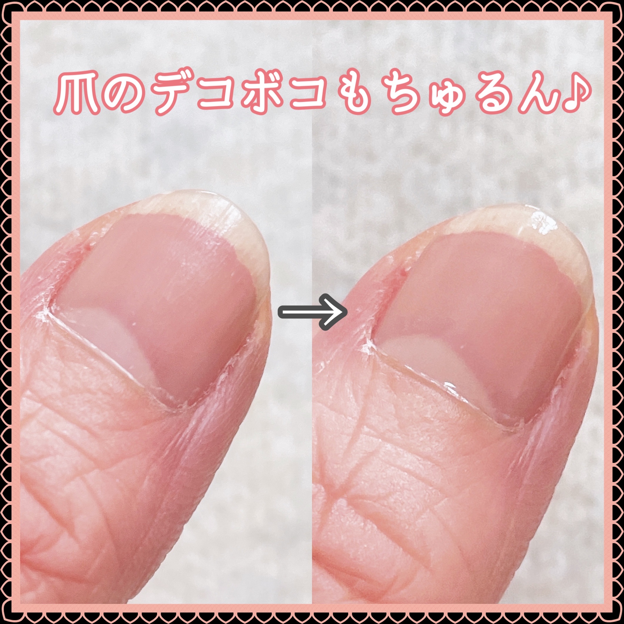 ディーアップファンデーション/D-UP/ネイルベースコートを使ったクチコミ（2枚目）