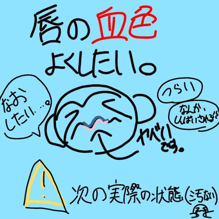オリジナル ピュアスキンジェリー/ヴァセリン/ボディクリームを使ったクチコミ(1枚目)