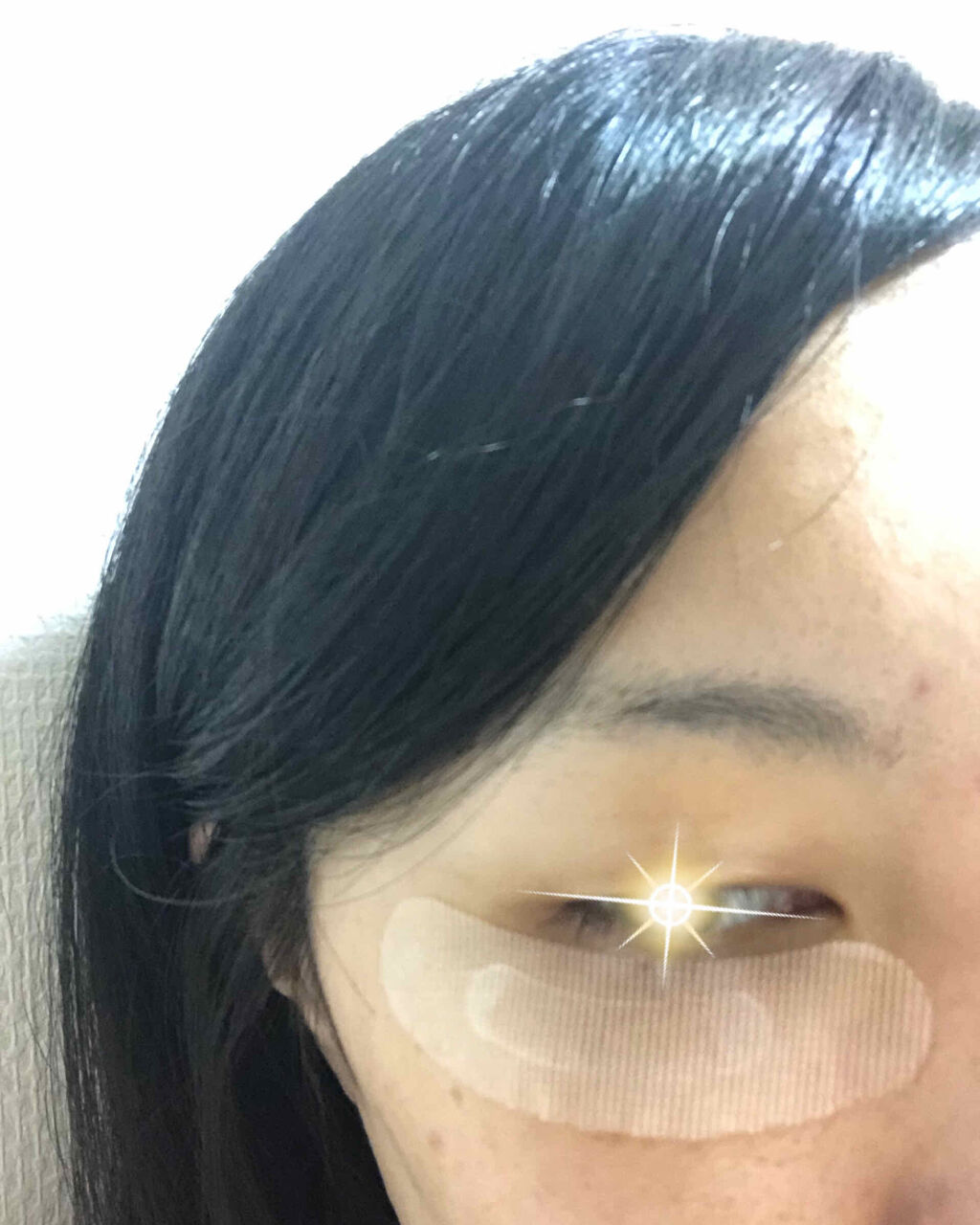 ナチュラベーレ THEマイクロニードル/ナチュラベーレ/シートマスク・パックを使ったクチコミ（2枚目）