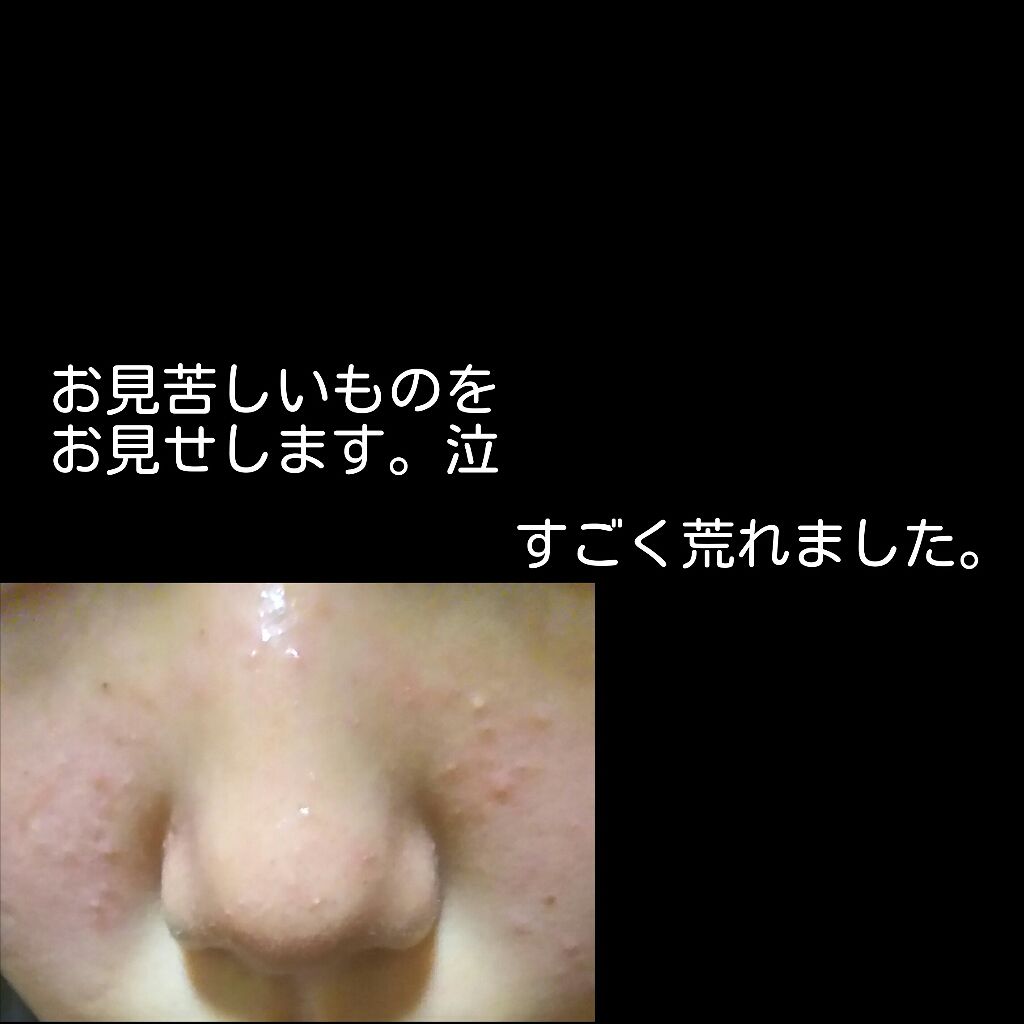 明色美顔水 薬用化粧水/美顔/化粧水を使ったクチコミ（2枚目）