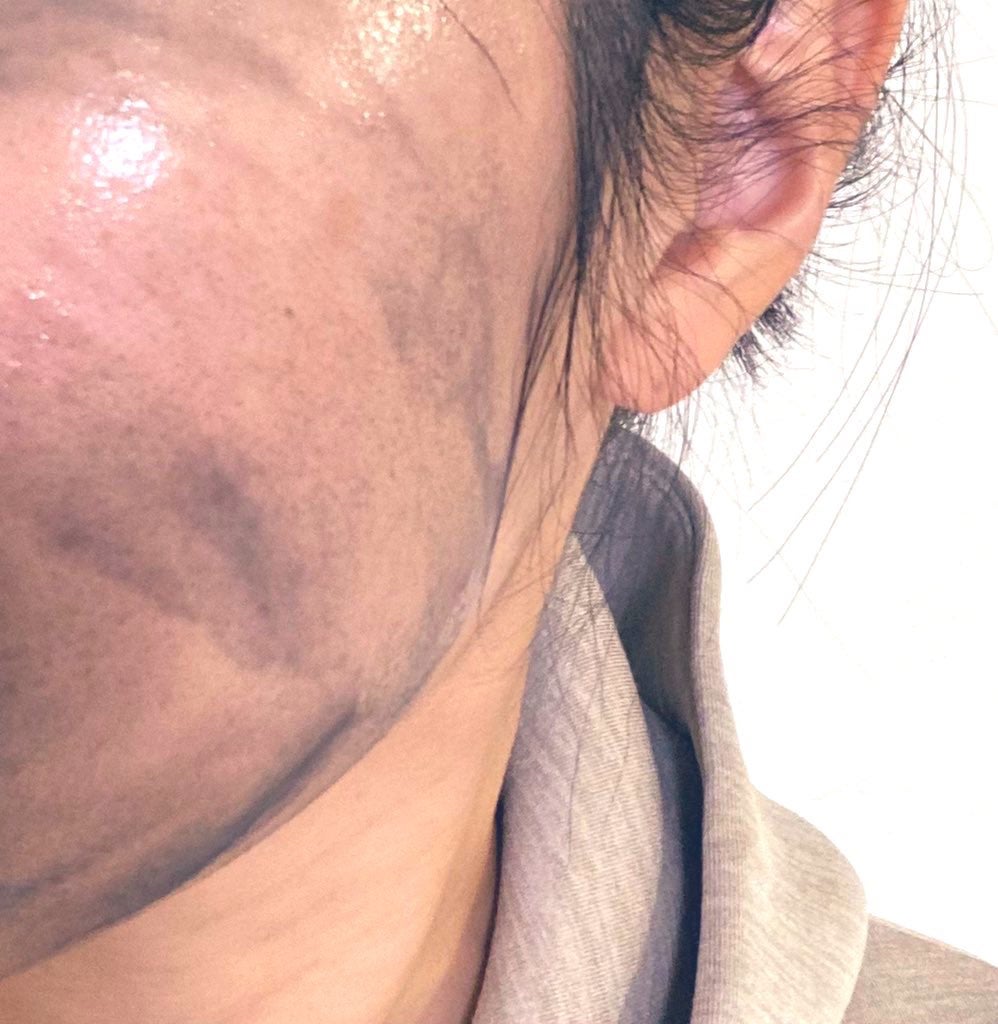 ソフティモ クリアプロ クレンジングバーム CICA ブラック/ソフティモ/クレンジングバームを使ったクチコミ(3枚目)