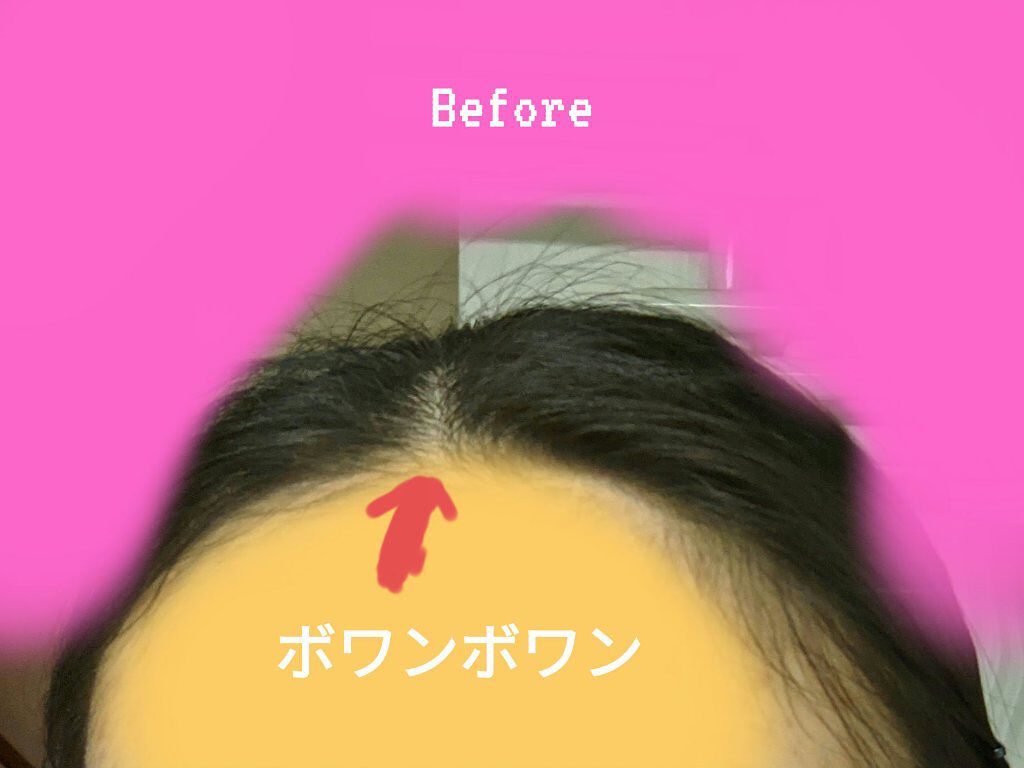 まとめ髪スティック スーパーホールド/マトメージュ/ヘアワックス・クリームを使ったクチコミ（2枚目）