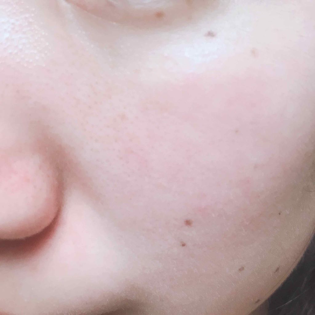 Cセラム/b.glen/美容液を使ったクチコミ（1枚目）