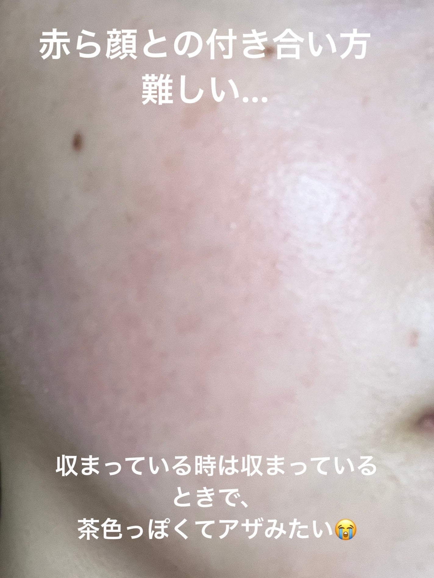 おひさまでつくったクレンジングオイル/エリデン/オイルクレンジングを使ったクチコミ(3枚目)